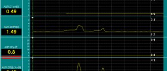 Параметры датчиков инжекторных двигателей ваз таблица